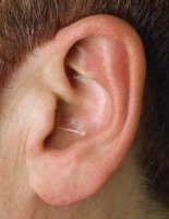 canal hearing aid available at UK Hearing Centres